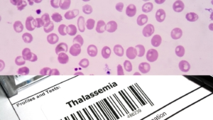 থ্যালাসেমিয়া কি? What is thalassemia?