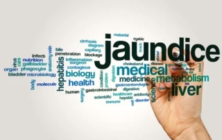 জন্ডিসের লক্ষণ ও প্রতিকার সম্পর্কে জেনে নিন 4 জন্ডিসের লক্ষণ