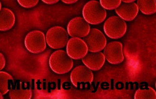 Multiple myeloma