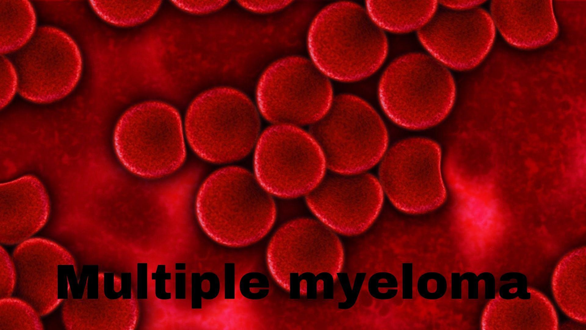 Multiple myeloma