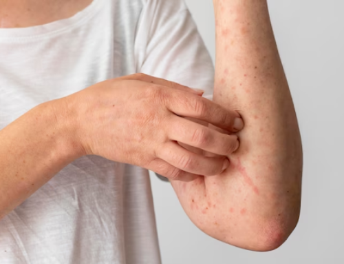 সেনসিটিভ ত্বক (Sensitive Skin): ৭টি কারণ এবং চিকিৎসা
