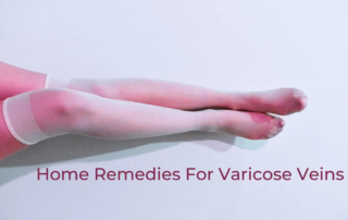 Home Remedies For Varicose