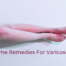 Home Remedies For Varicose